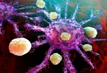 تجربة جديدة لعلاج الأورام الصلبة بالبكتيريا